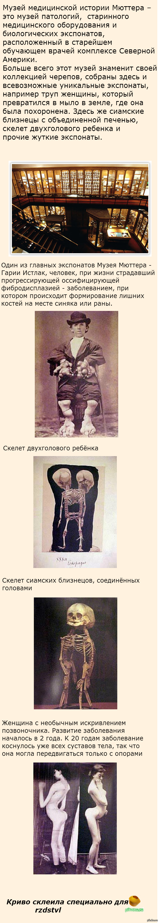 Музей медицинской истории мюттера филадельфия