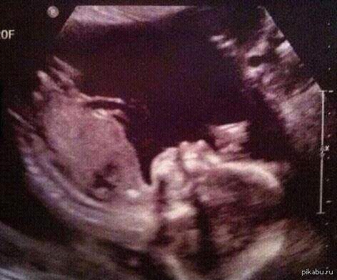 �� �������, ����� �� ���� ��� ���.