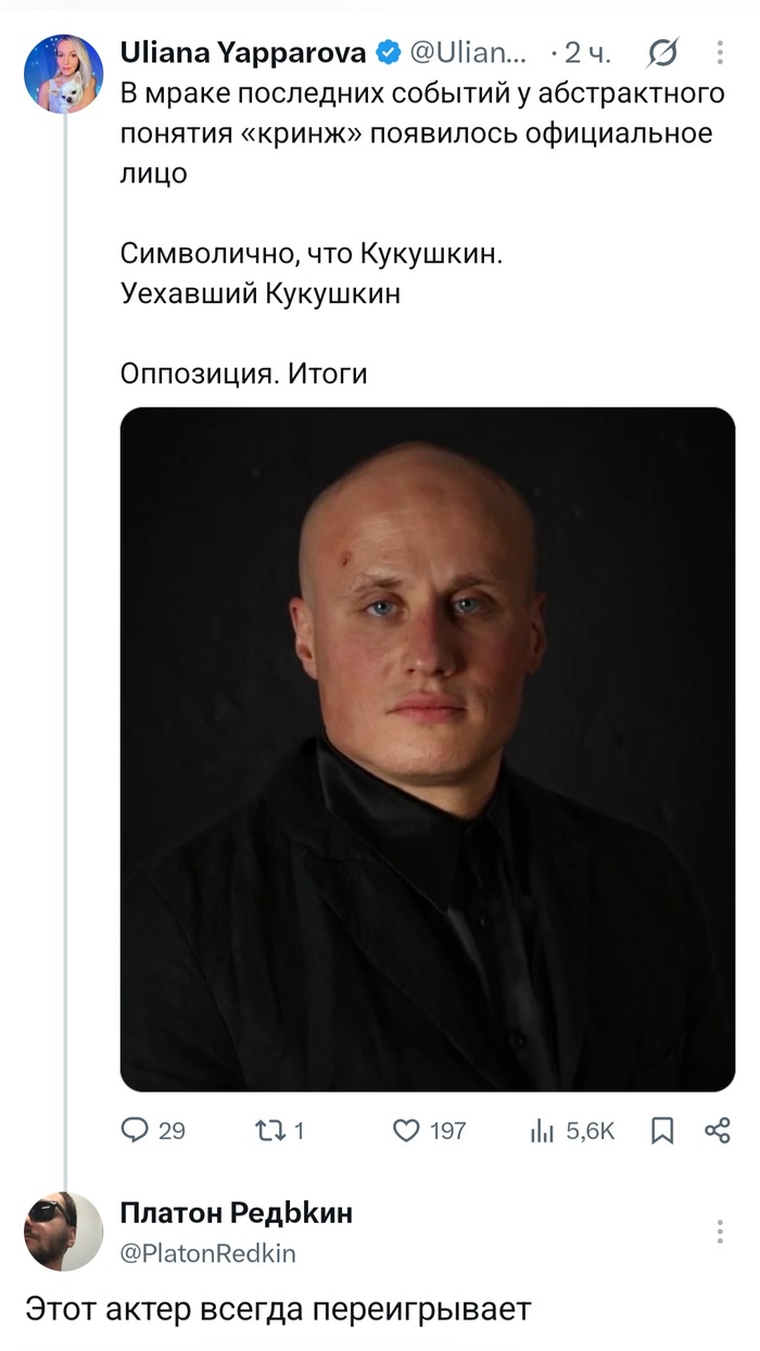 Актёр, который всегда переигрывает