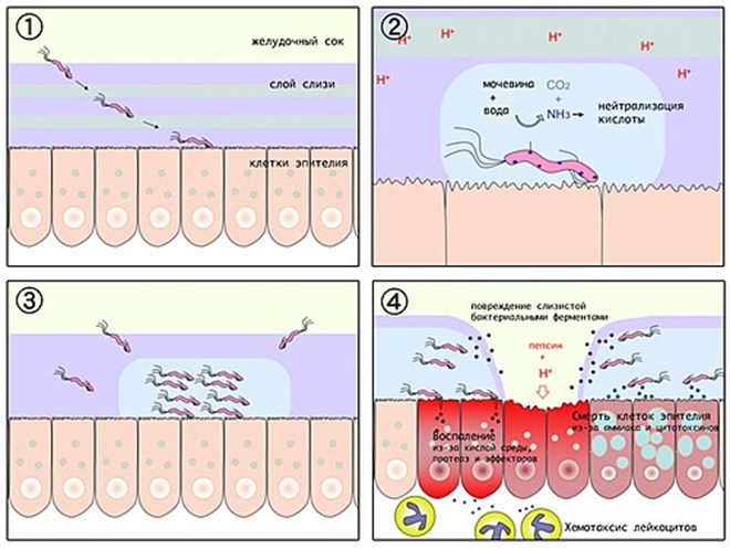 <a href="https://pikabu.ru/story/slepyie_pyatna_4_14409811?u=https%3A%2F%2Fru.wikipedia.org%2Fwiki%2FHelicobacter_pylori&t=%D0%9F%D0%B0%D1%82%D0%BE%D0%B3%D0%B5%D0%BD%D0%B5%D0%B7%20%D1%8F%D0%B7%D0%B2%D1%8B%20%D0%B6%D0%B5%D0%BB%D1%83%D0%B4%D0%BA%D0%B0&h=e94fe561cd8ae2178b3343eab23f2880a6e03d26" title="https://ru.wikipedia.org/wiki/Helicobacter_pylori" target="_blank" rel="nofollow noopener">Патогенез язвы желудка</a>
