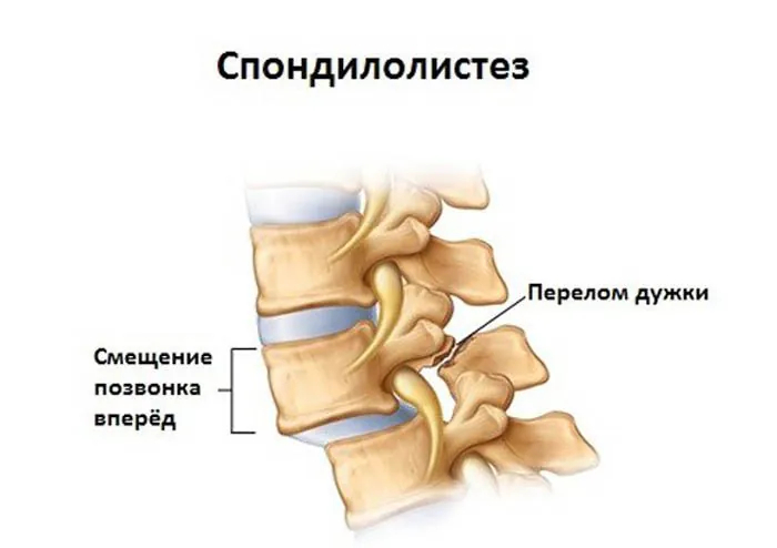 ��� ���� � ������������� ������� ������� ���� �� ������������ ����